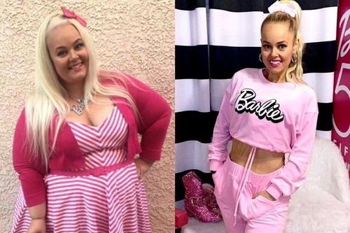 Người phụ nữ giảm 90 kg để giống búp bê Barbie