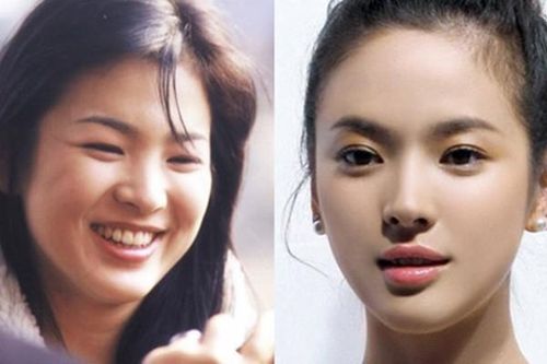 Song Hye Kyo mũm mĩm thuở mới vào nghề từng nặng tới 70kg
