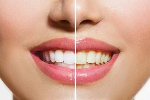 Răng trắng cực nhanh chỉ với 1 loại rau