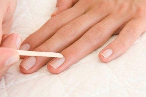 Móng tay có các dấu hiệu này, cẩn thận bị bệnh nguy hiểm mà không biết