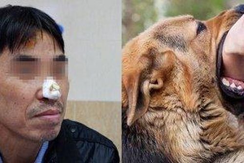 Chó nhà 'mất não' cắn bay da mũi của chủ khi được cho ăn