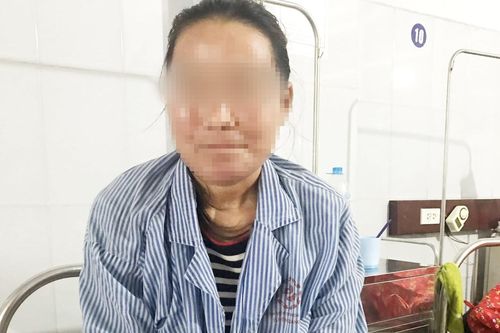 Người phụ nữ bị lở loét mặt do dị ứng kem trộn
