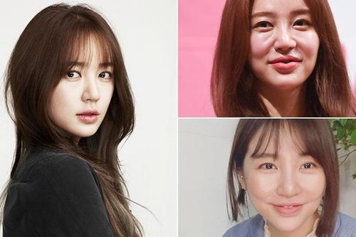 Hành trình nhan sắc từ đẹp tự nhiên đến 'xấu nhân tạo' của nữ diễn viên Yoon Eun Hye