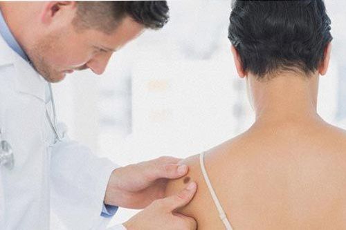 Top 10 dấu hiệu báo động bạn có thể bị ung thư