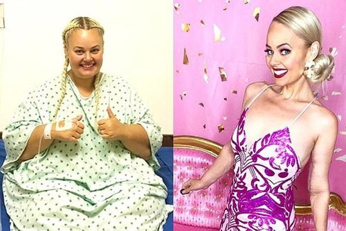 Nàng 'búp bê Barbie' phẫu thuật cắt bỏ 80% dạ dày lột xác cực xinh