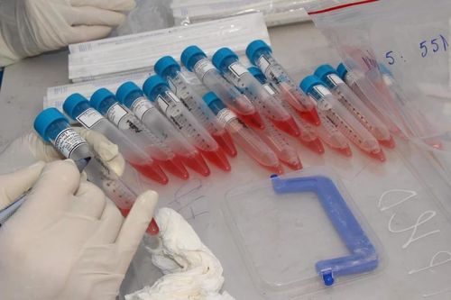 Hà Nội ghi nhận thêm ca mắc Covid-19 ở Cầu Giấy