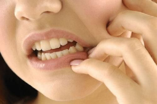 Bài thuốc chữa sâu răng từ lá lốt cực nhanh