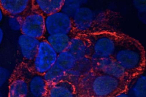 SARS-CoV-2 gây hại cho các tế bào phổi chỉ trong vài giờ như thế nào?