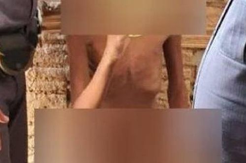 Bé 11 tuổi bị bố và mẹ kế xích ở ban công