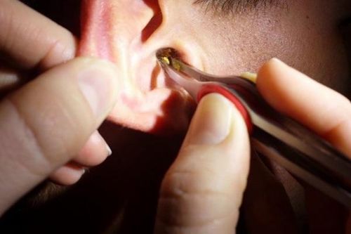 Ráy tai cũng có tác dụng