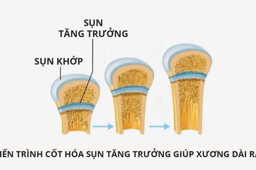 Hãy giúp con tăng chiều cao trước khi quá muộn