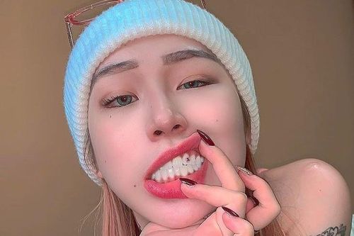 Gắn kim cương lên trán và các kiểu làm đẹp độc lạ của rapper