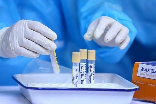 100/934 mẫu xét nghiệm liên quan ca mắc COVID-19 ở chung cư Láng Hạ âm tính lần 1
