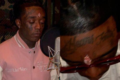 Nam rapper cấy kim cương hồng 24 triệu USD lên trán