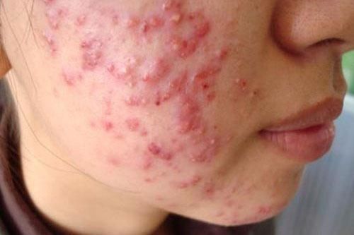 Dấu hiệu bệnh trên khuôn mặt bạn phải đi khám gấp