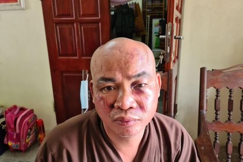 Sư chùa Thiên Mụ ở Hải Phòng bị hai người đánh vỡ xương mũi