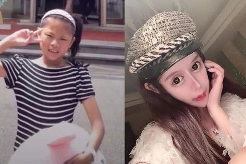 Rich kid Trung Quốc nghiện phẫu thuật thẩm mỹ, khuôn mặt như mặt rắn