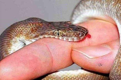 Bé gái 9 tuổi thoát chết thần kỳ khi bị rắn vua cực độc cắn trộm