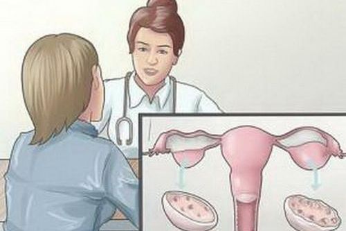 Đừng nghĩ u nang buồng trứng không nguy hiểm