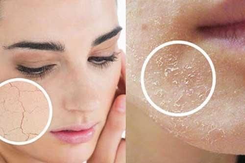 Những lưu ý về chăm sóc da mùa lạnh