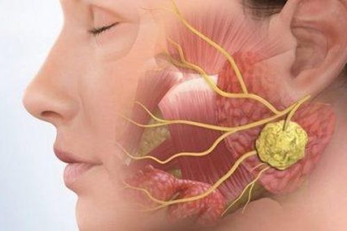 Phân biệt ung thư vòm họng với bệnh lý vùng mũi họng