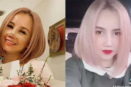 Soi nhan sắc của 'cô Xuyến' Hoàng Yến sau khi sửa mũi