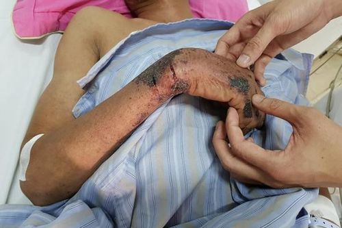 Mổ lợn đánh tiết canh đón Tết - Coi chừng mắc bệnh chết người