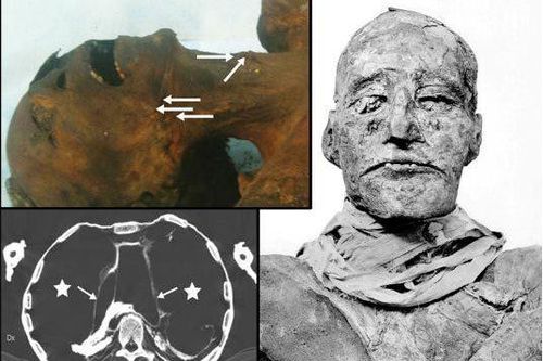 Hé lộ vụ ám sát dã man vua pharaoh Ai Cập