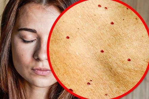 Đang ở độ tuổi đôi mươi mà thấy 8 dấu hiệu trên khuôn mặt thì hãy coi chừng bạn đang bắt đầu già đi nhanh chóng
