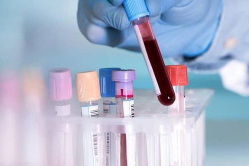 Hưng Yên: Xét nghiệm hơn 1000 trường hợp liên quan đến 3 ca dương tính SARS-CoV-2