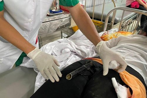Một tai nạn hy hữu sau va chạm giao thông