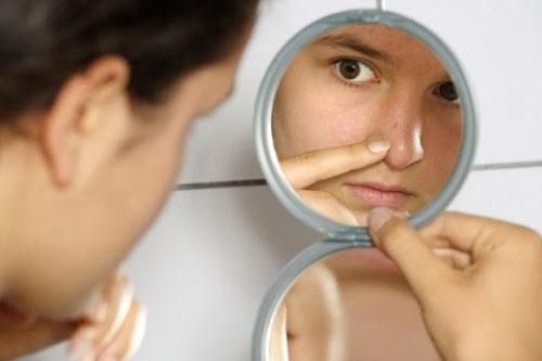 3 cách sạch mụn đầu đen mà không mất tiền