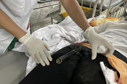 Hy hữu chân chống xe máy găm chặt vào mông cô gái sau tai nạn