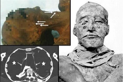 Hé lộ vụ ám sát dã man vua pharaoh Ai Cập