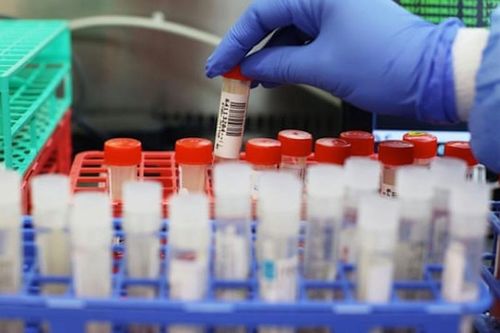 Anh phát hiện biến thể nCoV mới đáng sợ, đã xuất hiện ở nhiều nước