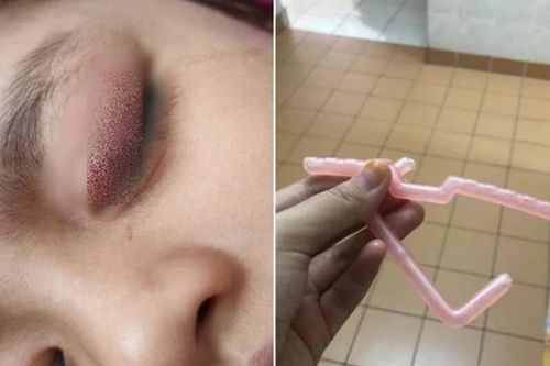 Người mẹ vô ý làm rơi mảnh mắc áo gãy, tai nạn bất ngờ đã xảy ra với cô con gái nhỏ