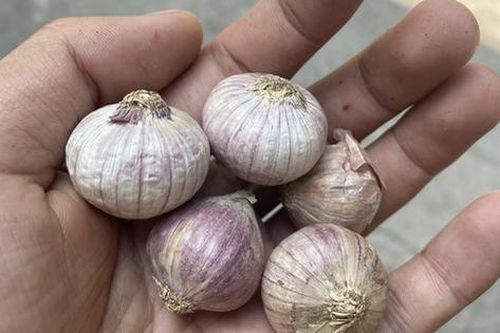 Bác sĩ da liễu tiết lộ 10 cách đơn giản để da phục hồi, sáng rạng ngời sau Tết Nguyên đán