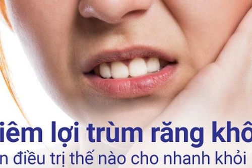 Viêm lợi trùm răng khôn cần điều trị thế nào cho nhanh khỏi?