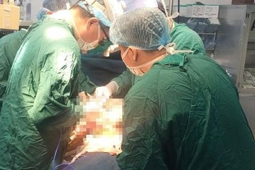 Thủng bụng, ruột non chui ra ngoài do đùa nghịch ngày Tết