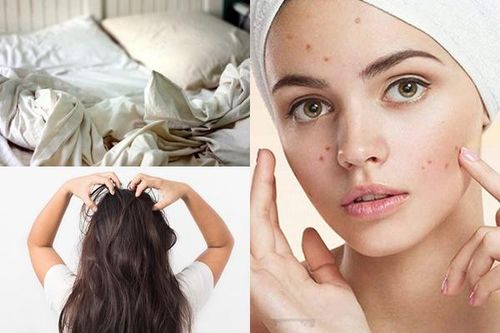Điều gì xảy ra với sức khỏe khi không giặt giũ chăn gối thường xuyên?