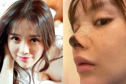 Ám ảnh ngoại hình trong giới giải trí Hoa ngữ