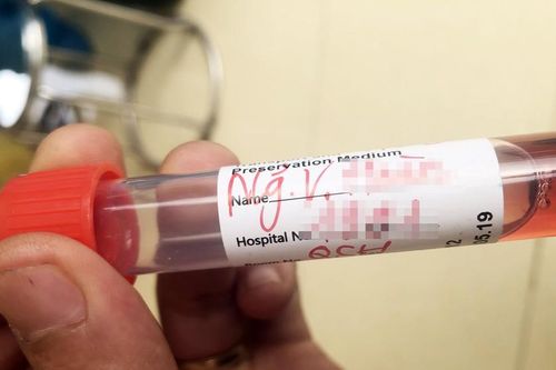 Thợ xây dương tính SARS-CoV-2, huyện Kim Thành Hải Dương khẩn cấp truy vết F1, F2
