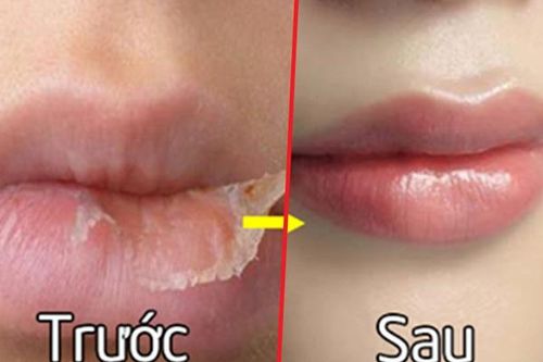Là con gái, nàng nhất định nên nắm vững những bí quyết dưỡng môi đơn giản này