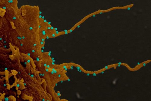 Con người có thể trở thành thây ma khi bị nhiễm virus SARS-CoV-2 ở đời thực?
