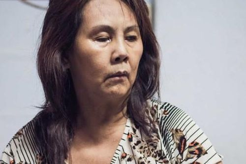 Nghệ sĩ Hoàng Lan bị hoại tử và mù một bên mắt