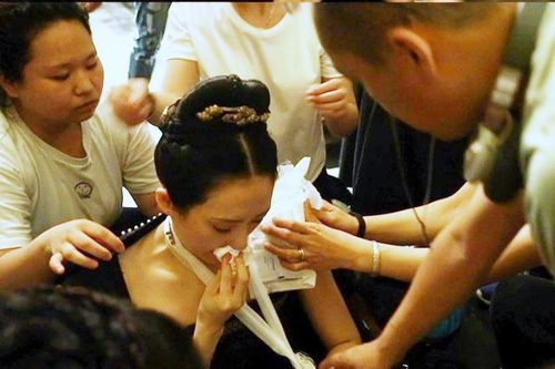 Chương Tử Di bị thương trên phim trường