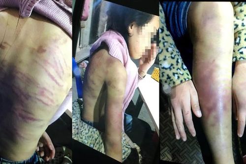 Bé gái 12 tuổi nghi bị bạo hành, xâm hại tình dục: Cần khởi tố mẹ và người tình