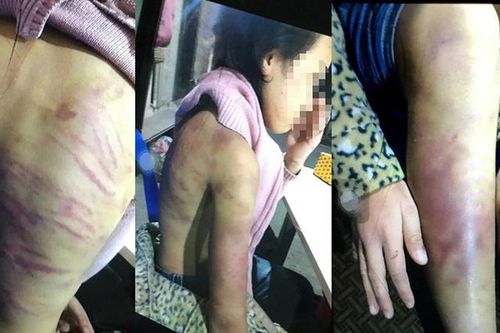 Vụ bé gái 12 tuổi bị bạo hành: Người mẹ đang chờ xét xử tội tàng trữ trái phép chất ma túy