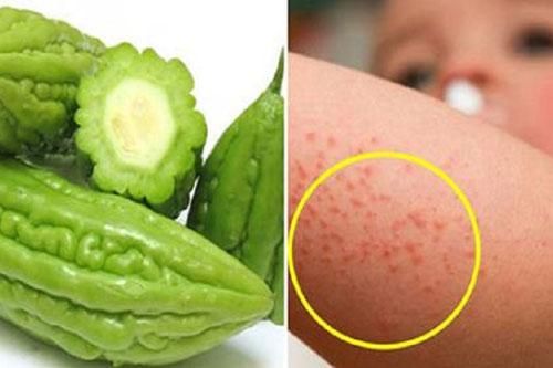 4 cách chữa rôm sảy đơn giản nhất mà mẹ có thể làm cho bé