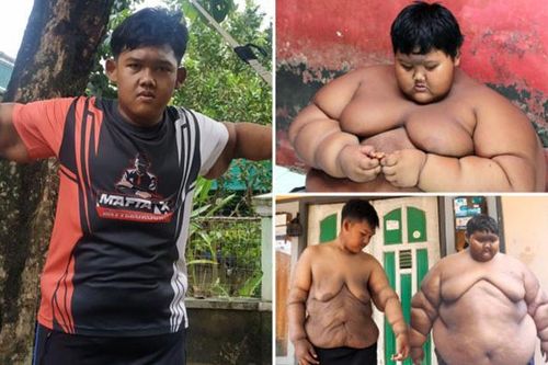 Hành trình 'lột xác' giảm 105 kg, trút bỏ da thừa của cậu bé béo nhất thế giới